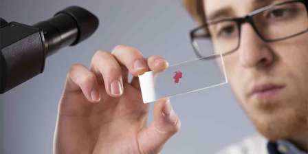 blood sample examined by lab technician