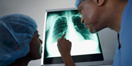 medicos looking at xray
